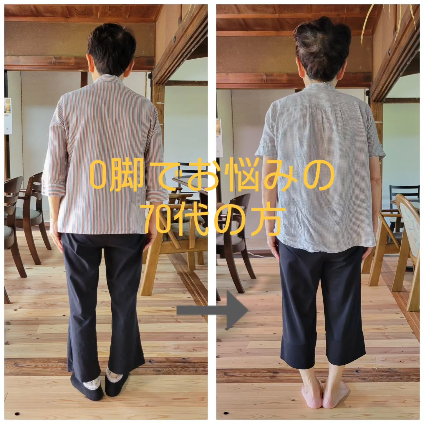 O脚でお悩みの方