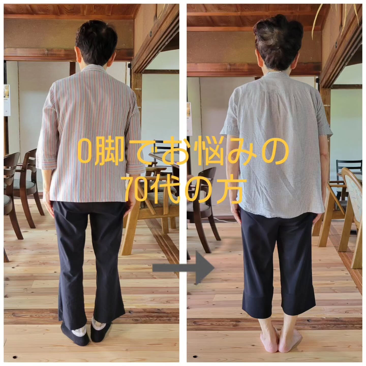 O脚でお悩みの方